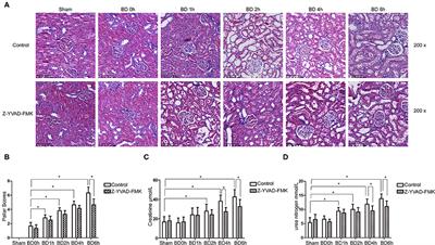 Caspase-1 Inhibitor Reduces Pyroptosis Induced by Brain Death in Kidney